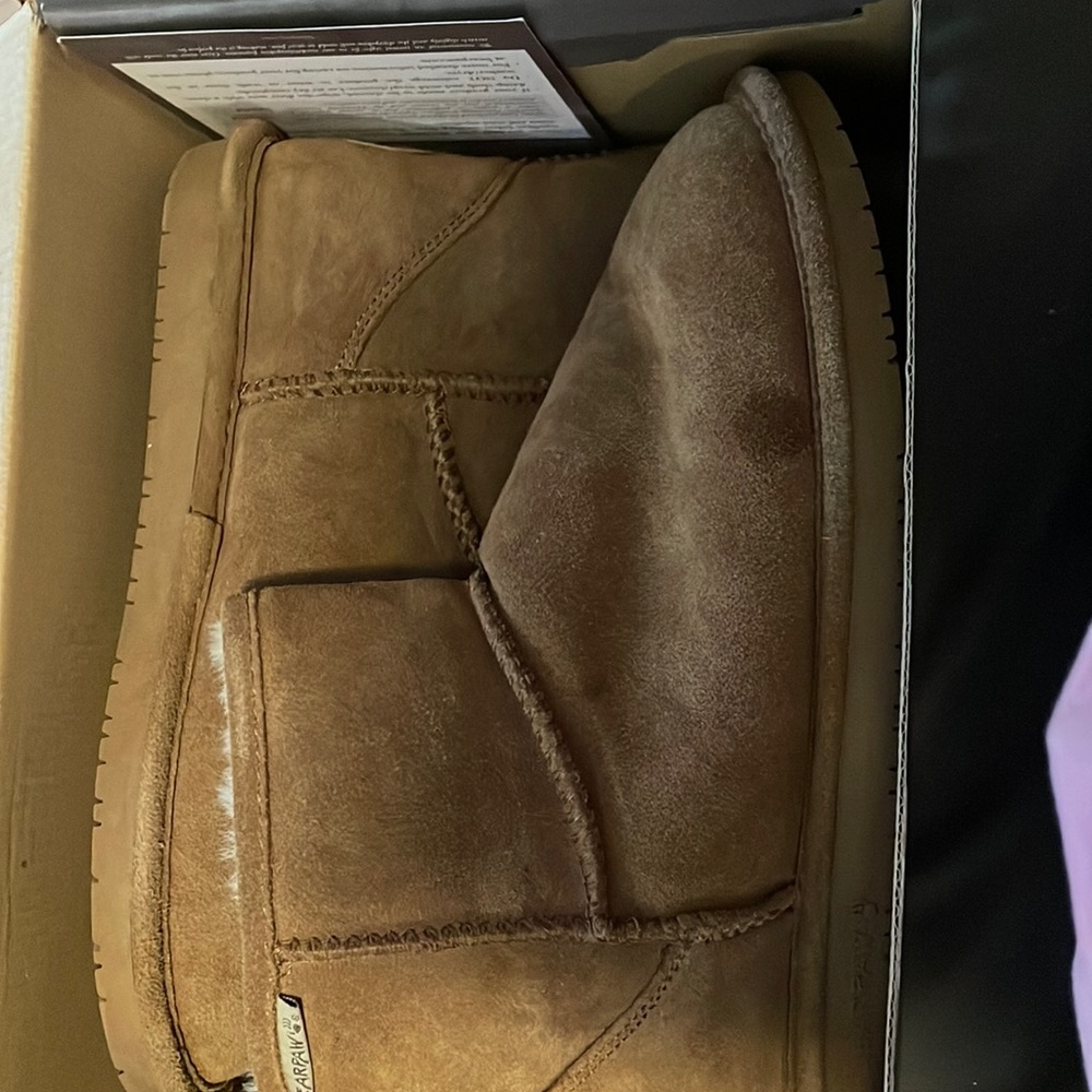 worn less then 10 times has stain shown in picture